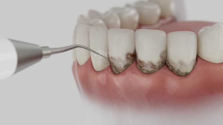 Reliable Dental contractor in Lake Odessa, MI by Dentist Open Now